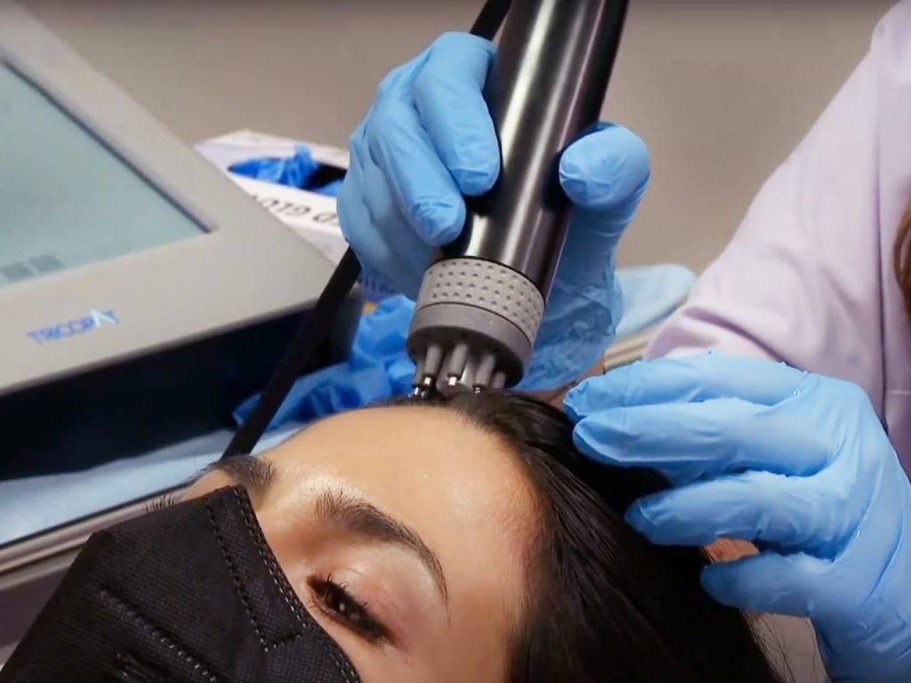 Tricopat procedura plaukams ir plauku slinkimui